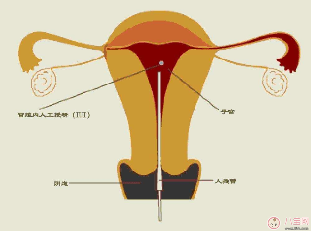 现在做赠卵试管代生代怀的费用是多少？