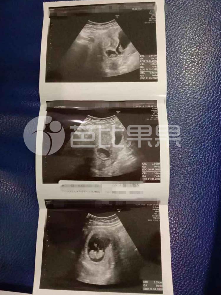 青海省人民医院做供卵试管婴儿助孕怎么样